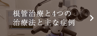 根管治療と4つの治療法と主な症例